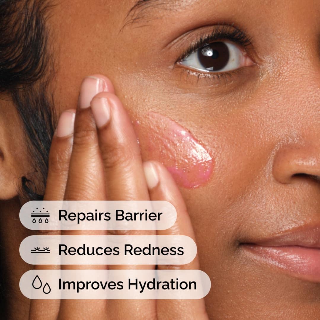 The Ordinary Soothing and Barrier Support Serum 30ml - Image 4