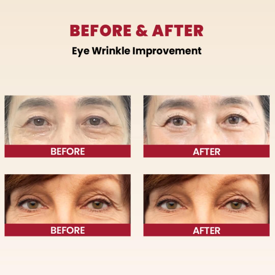 Ksecret Seoul 1988 Eye Cream : Retinal Liposome 4% + Fermented Bean 30ml - Image 8