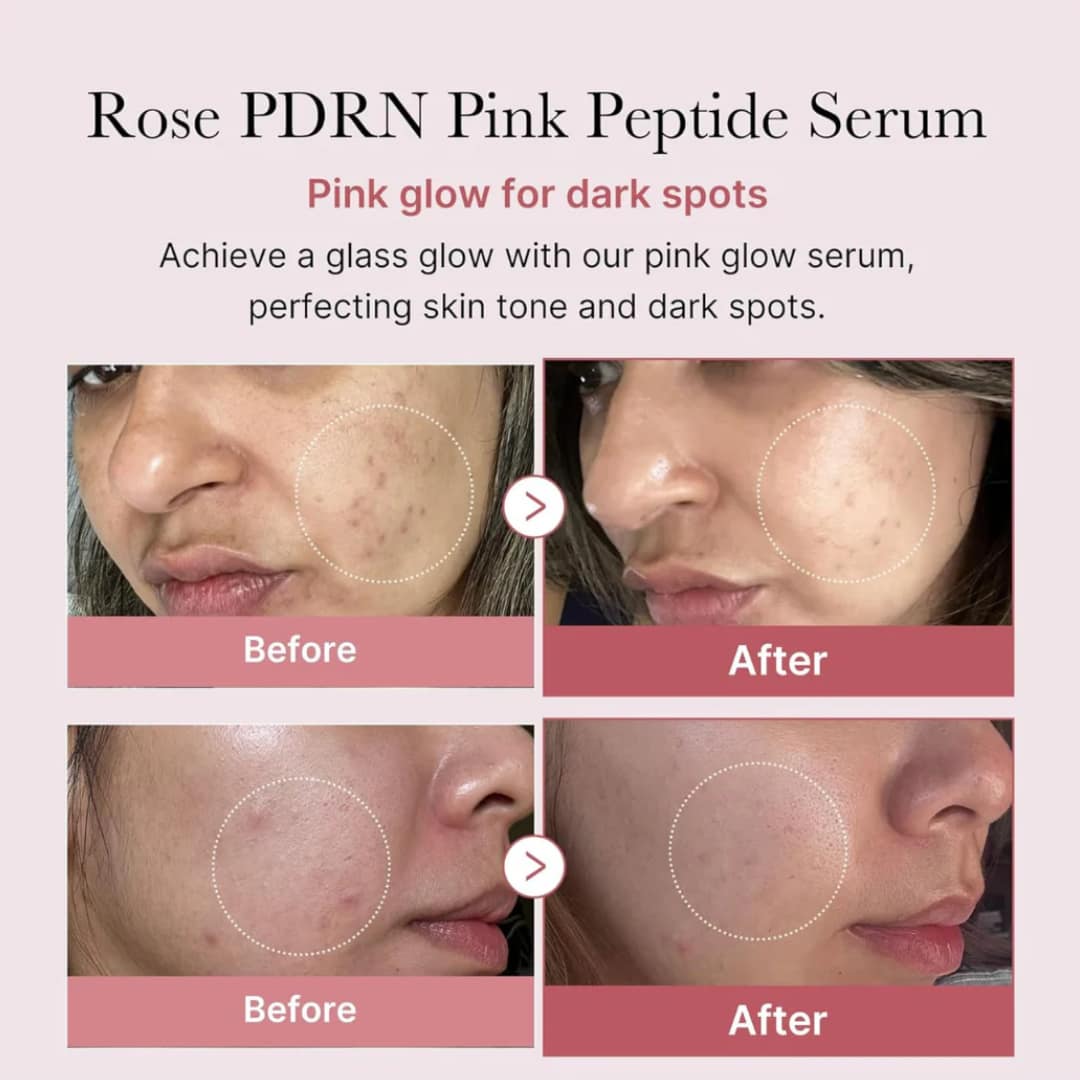 Medicube Pdrn Pink Peptide Serum 30ml - Image 2