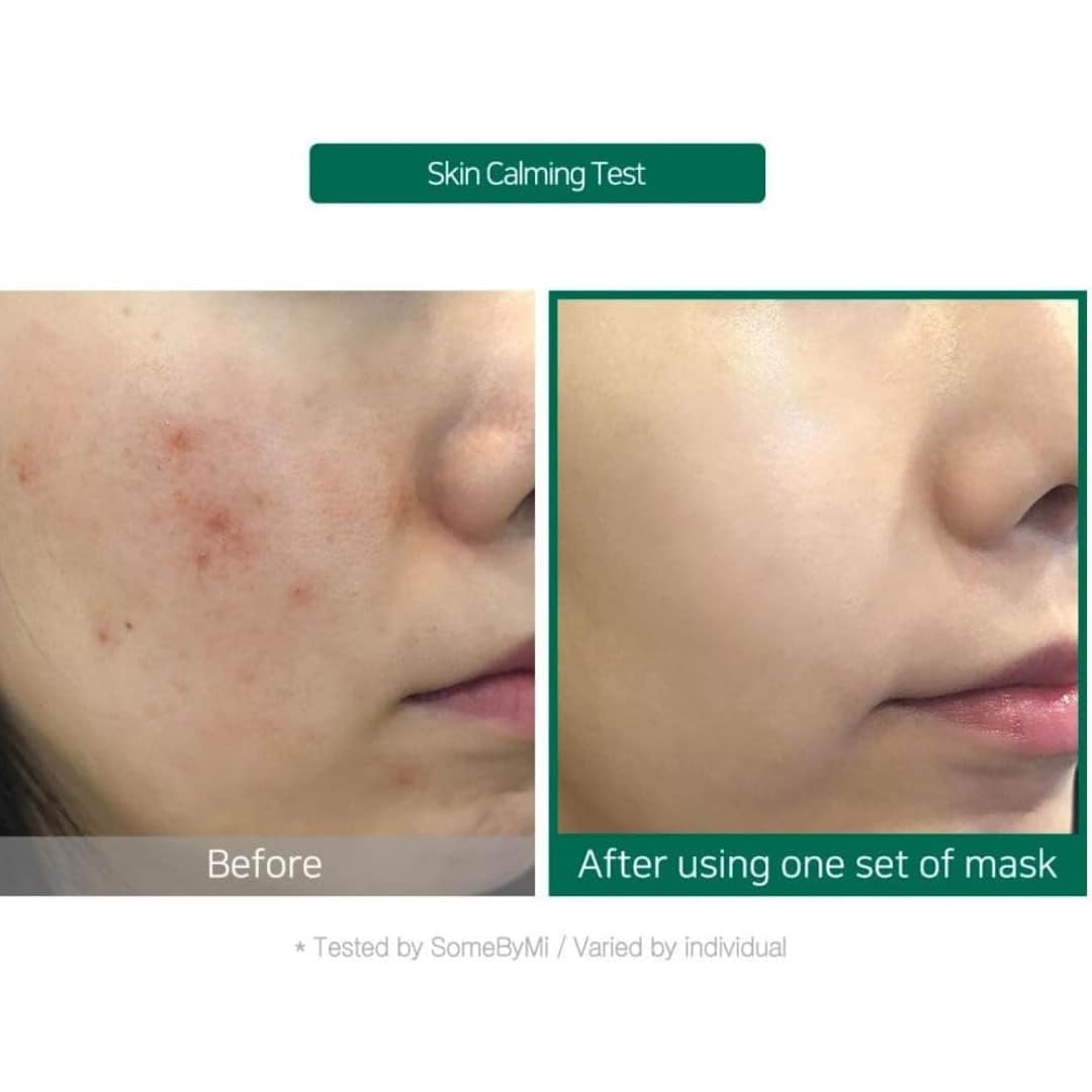 Some-By-Mi-Hyaluron-Moisturizing-Glow-Luminous-Ampoule-Mask-25g1ea