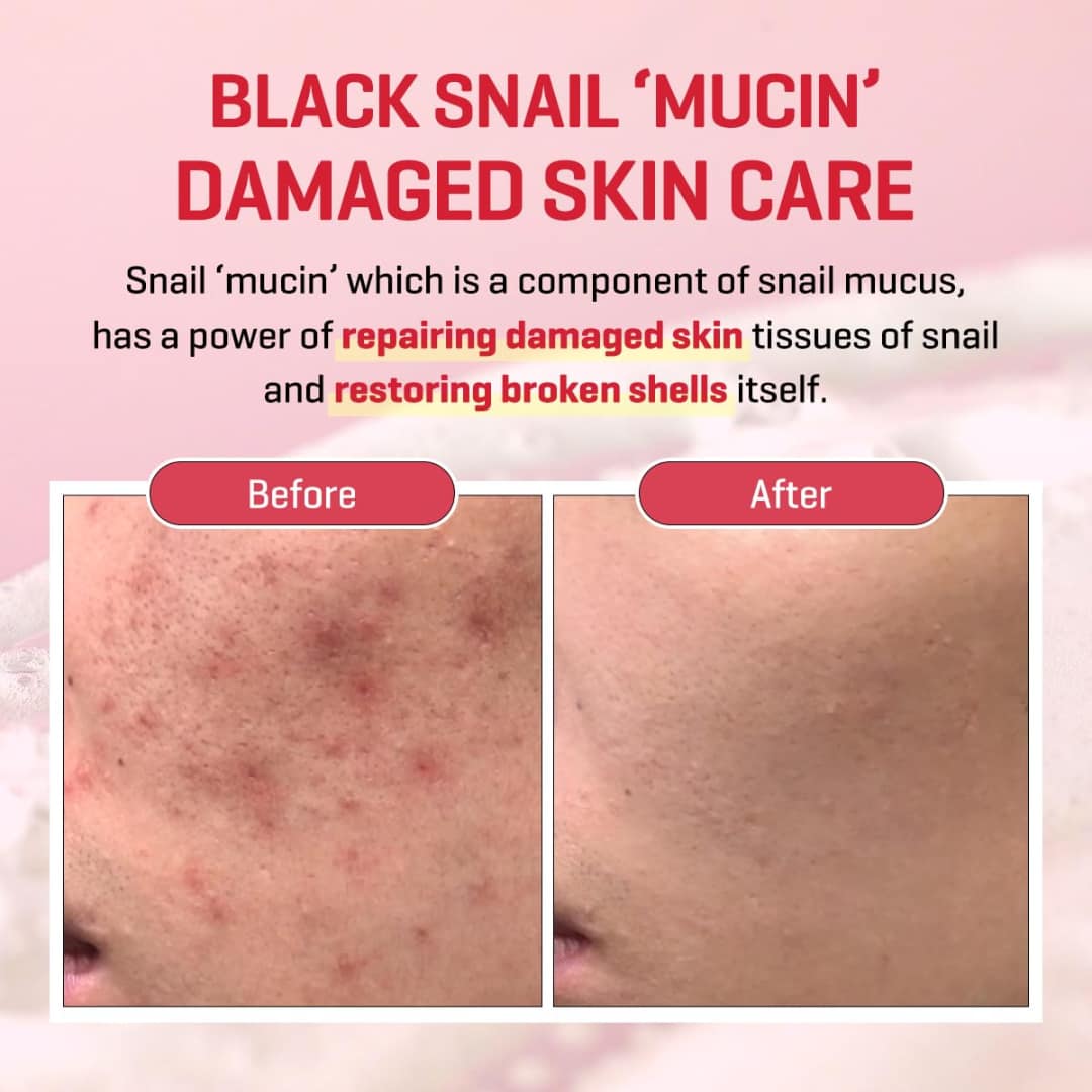 Some-By-Mi-Snail-Truecica-Miracle-Repair-Low-Ph-Gel-Cleanser