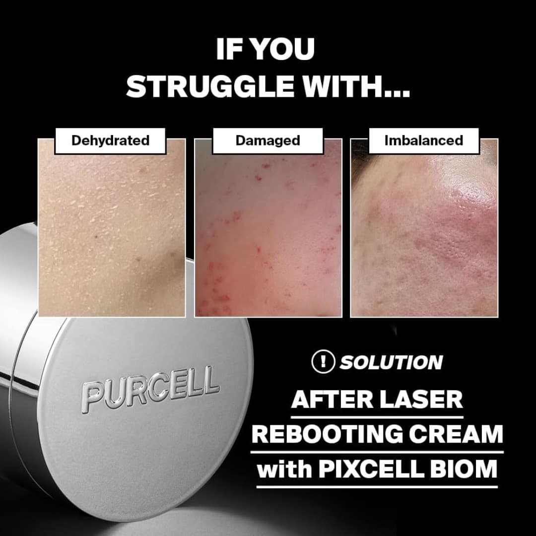 Purcell Pixcell Biom After Laser Rebooting Cream 50ml