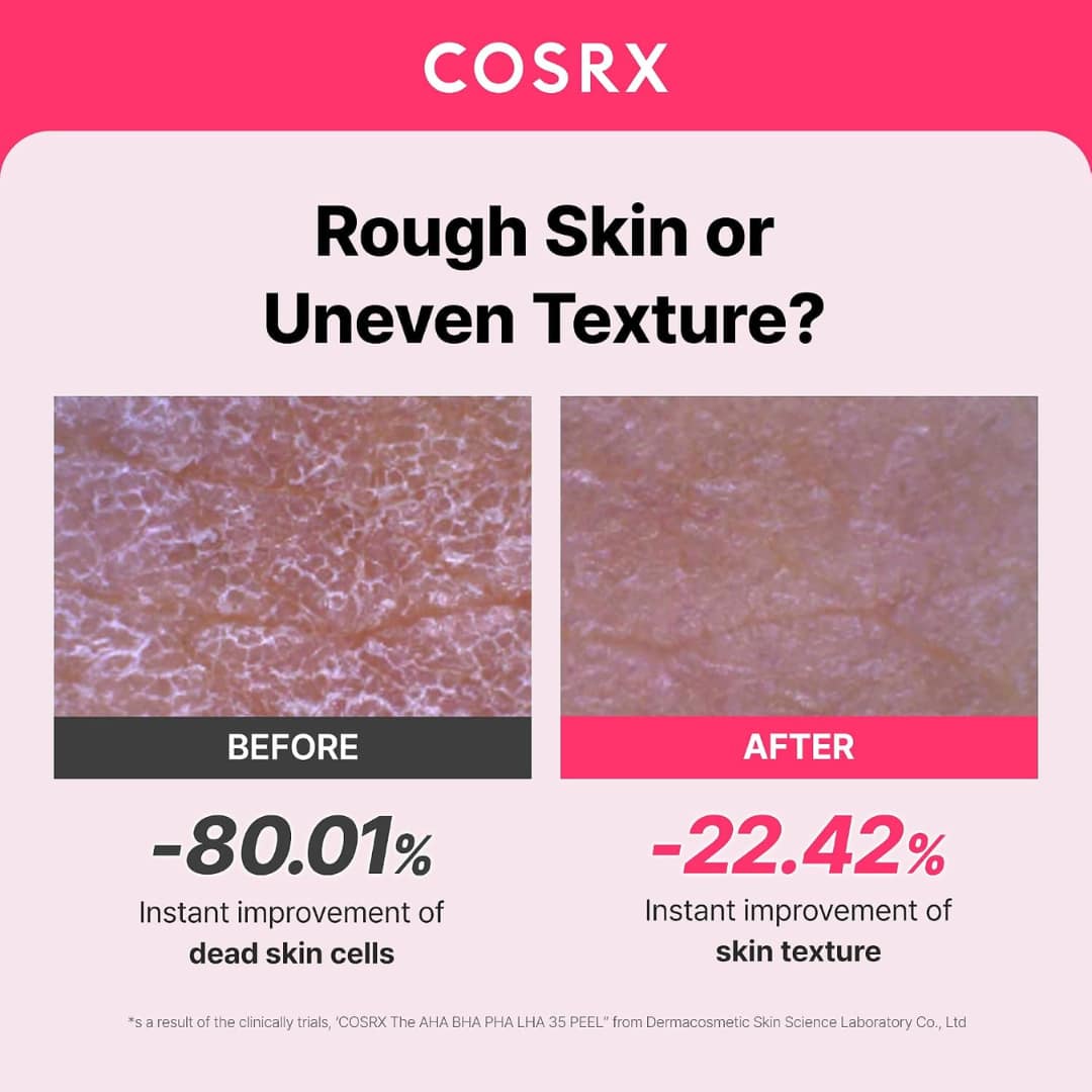 Cosrx AHA BHA PHA LHA 35 Peel 30ml