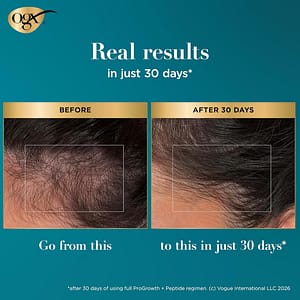 OGX-Pro-Growth-Peptide-Scalp-Serum-10ml